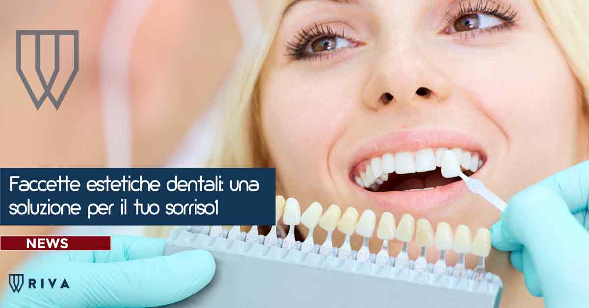 Faccette estetiche dentali: una soluzione per il tuo sorriso! | Riva Dental Clinic